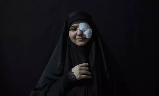 Zeinab Mestrah, 26, who was wounded in the pagers attack carried out by Israel on September 17, 2024, poses for a photograph in the Dahiyeh suburb of Beirut, Lebanon, Friday, April 25, 2025. (AP Photo/Hassan Ammar)