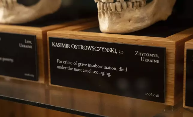 The skull of Kasimir Ostrowsczynski displayed at the Mütter Museum on Thursday, Aug. 21, 2025, in Philadelphia. (AP Photo/Mingson Lau)