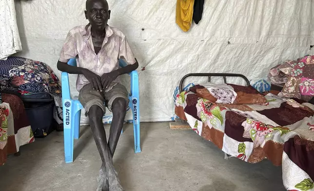 Michael Deng Dut, 29 years-old, who says he was electrocuted more than 18 times after his arrest by the Sudanese Armed Forces, poses for a photo during an interview with The Associated Press in Renk, South Sudan, Thursday, Aug 7, 2025. (AP Photo/Adlai Coleman)