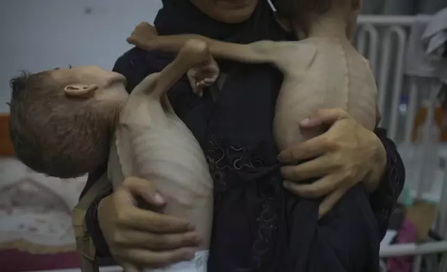 Omniya Mahra, holds shirtless for a photo her sons Oday, 4, left, and Mohammed, 3, who suffer from malnutrition and a genetic nerve disorder, at the Friends of the Patient Hospital in Gaza City, Tuesday, July 29, 2025. In Gaza, malnutrition is often worsened by preexisting conditions and compounded by illnesses linked to inadequate health care and poor sanitation, largely the result of the ongoing war. (AP Photo/Jehad Alshrafi)