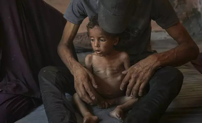 Yazan Abu Ful, a 2-year-old malnourished child, sits with his father for a picture at their home in the Shati refugee camp in Gaza City, Wednesday, July 23, 2025. In Gaza, malnutrition is often worsened by preexisting conditions and compounded by illnesses linked to inadequate health care and poor sanitation, largely the result of the ongoing war. (AP Photo/Jehad Alshrafi)