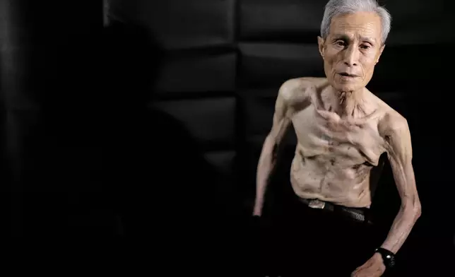 Sumiteru Taniguchi, a survivor of the 1945 atomic bombing of Nagasaki, sits for a photo during an interview at his office in Nagasaki, Nagasaki Prefecture, southern Japan, June 30, 2015. (AP Photo/Eugene Hoshiko)