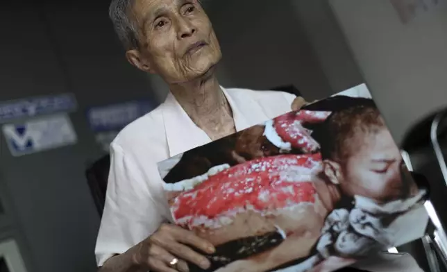 FILE - Sumiteru Taniguchi, 86, a survivor of the 1945 atomic bombing of Nagasaki, shows a photo of himself taken in 1945, during an interview at his office in Nagasaki, southern Japan, June 30, 2015. (AP Photo/Eugene Hoshiko, File)