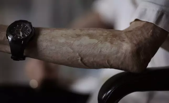 FILE - Sumiteru Taniguchi, 86, a survivor of the 1945 atomic bombing of Nagasaki, speaks as he shows the scars in his arm during an interview at his office in Nagasaki, southern Japan, June 30, 2015. (AP Photo/Eugene Hoshiko)