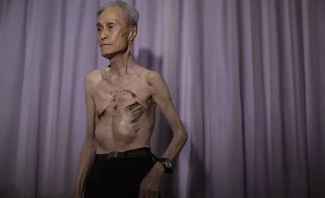 FILE - Sumiteru Taniguchi, 86, a survivor of the 1945 atomic bombing of Nagasaki, stands for photos during an interview at his office in Nagasaki, southern Japan, June 30, 2015. (AP Photo/Eugene Hoshiko, File)