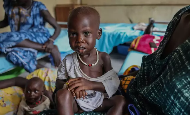 Adut Duor, 14 months old, sits on his mother's lap in the malnutrition ward of Bunj Hospital in Maban, South Sudan, Monday, Aug. 18, 2025. (AP Photo/Caitlin Kelly)