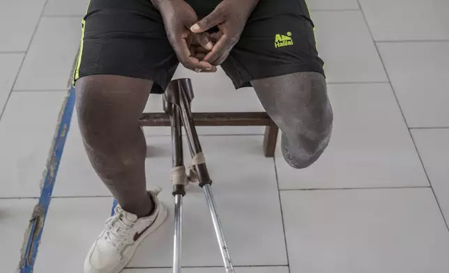 Jerome Jean-Claude Amani, one of many wounded by fighting in the region, waits for his prosthetic leg at an orthopedic center run by the Catholic church and supported by Red Cross in Goma, eastern Congo, Friday, Aug. 29, 2025. (AP Photo/Moses Sawasawa)
