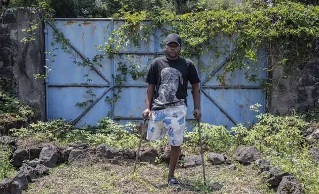Faustin Amani, one of many wounded by fighting in the region, poses for a photo at an orthopedic center run by the Catholic church and supported by Red Cross in Goma, eastern Congo, Friday, Aug. 29, 2025. (AP Photo/Moses Sawasawa)