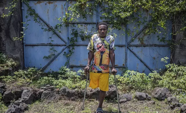 Patrick Mauka, one of many wounded by fighting in the region, poses for a photo at an orthopedic center run by the Catholic church and supported by Red Cross in Goma, eastern Congo, Friday, Aug. 29, 2025. (AP Photo/Moses Sawasawa)
