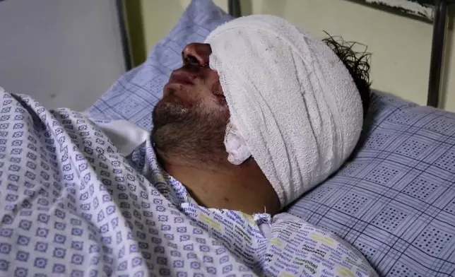 Cricketer Mira Jan lies wounded in a hospital bed after a Pakistani cross-border airstrike that killed several people, including three other local cricketers, at the regional hospital in Afghanistan's eastern Paktika province, Saturday, Oct. 18, 2025. (AP Photo/Shafiqullah Mashaal)