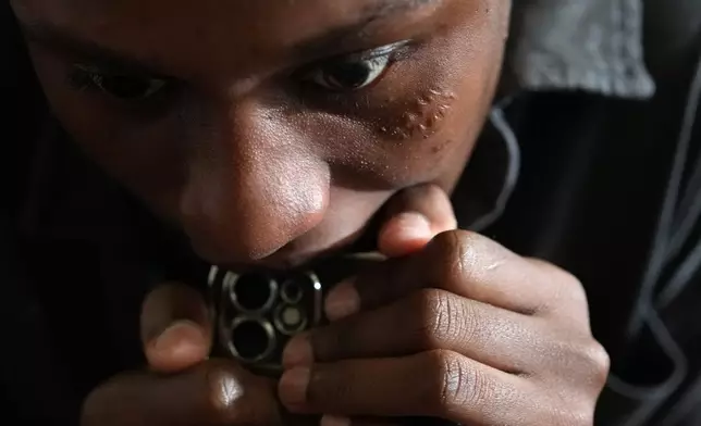 Detamisse Janvier, 20, reacts as she talks about the circumstances that led her to flee Haiti and seek asylum in the U.S., in Orlando, Fla., Friday, Aug. 22, 2025. Janvier's face still bears a scar from being injured while running desperately to escape an attack by an armed gang on her home in Port-au-Prince. (AP Photo/Rebecca Blackwell)