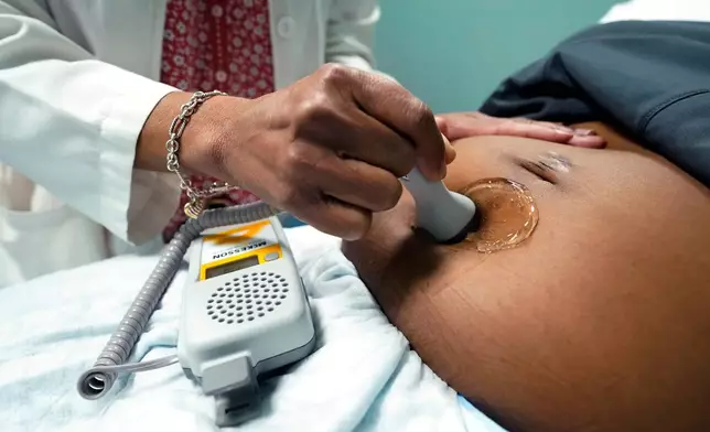 FILE - A doctor uses a hand-held Doppler probe on a pregnant woman to measure the heartbeat of the fetus, Dec. 17, 2021, in Jackson, Miss. (AP Photo/Rogelio V. Solis, File)