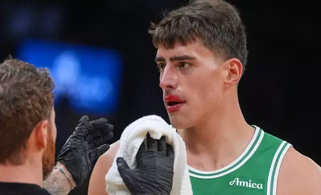 Boston Celtics center Luka Garza has his bloodied face examined during the second half of an NBA basketball game against the Philadelphia 76ers, Wednesday, Oct. 22, 2025, in Boston. (AP Photo/Charles Krupa)