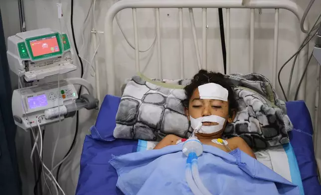 Nabila Shorbasi, who was injured by an unexploded ordnance along with her six-year-old twin brother Yahya, lies on a bed at Patient's Friends Charity Hospital in Gaza City, Saturday, Oct. 25, 2025. (AP Photo/Abdel Kareem Hana)