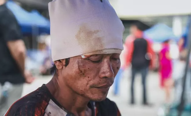 A man injured in an earthquake is seen outside the Cebu Provincial Hospital in Bogo City, Philippines, Wednesday, Oct. 1, 2025. (AP Photo/Jacqueline Hernandez)