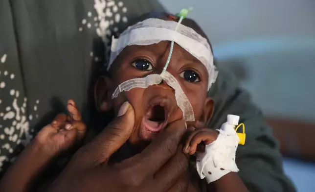 A mother sits with her malnourished baby at Banadir Hospital in Mogadishu, Somalia, Tuesday, Nov. 11, 2025. (AP Photo/Farah Abdi Warsameh)
