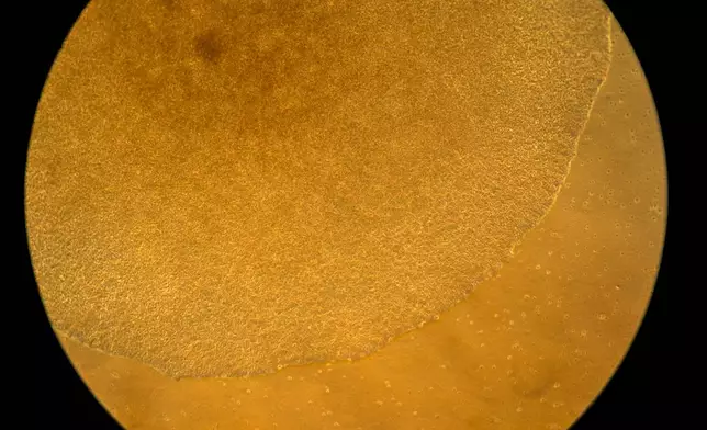 Human stem cells used in research into autoimmune diseases are visible under a microscope in a lab at the National Institutes of Health, Monday, Aug. 25, 2025, in Bethesda, Md. (AP Photo/David Goldman)