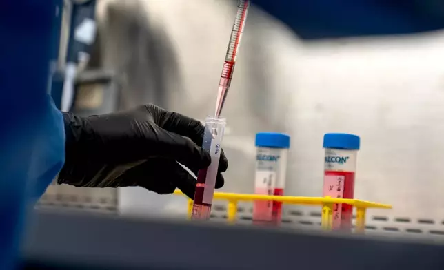 Dr. Justin Kwong, a research fellow who coaxes human stem cells to grow into a kind of immune cell involved in autoimmune diseases, works in a lab at the National Institutes of Health, Tuesday, Jan 21, 2025, in Bethesda, Md. (AP Photo/David Goldman)