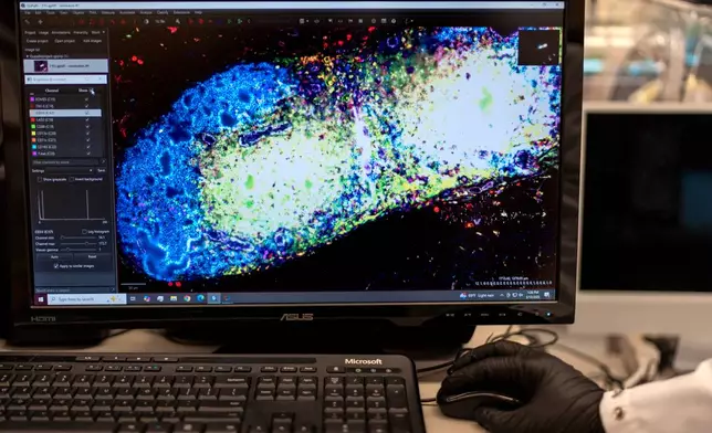 Research fellow Sachin Surwase shows an image of a pancreatic lymph node from a mouse in the lab where he studies autoimmune diseases at Johns Hopkins University in Baltimore, Md., Tuesday, May 13, 2025. (AP Photo/David Goldman)