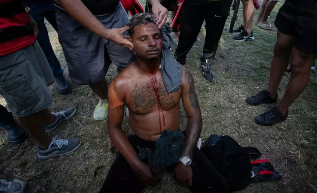 A Flamengo soccer fan sits injured in the head during clashes with police as the team arrives at the airport before flying to Peru for the Copa Libertadores final, in Rio de Janeiro, Wednesday, Nov. 26, 2025. (AP Photo/Bruna Prado)