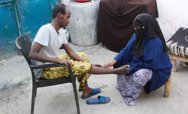 Mohamed Abdi Awale, who says he was captured and tortured by smugglers while attempting to reach Europe, shows his mother wounds during an interview with The Associated Press in Mogadishu, Somalia, Monday, Nov. 17, 2025. (AP Photo/Farah Abdi Warsameh)