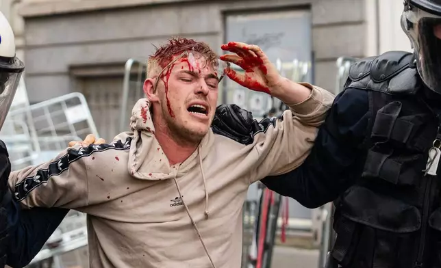 Police carry away a man who was injured in clashes during a demonstration of European farmers near the European Parliament in Brussels, Thursday, Dec. 18, 2025. (AP Photo/Marius Burgelman)