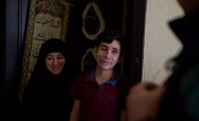 Hussein Dheini, 12, who was wounded in the pagers attack carried out by Israel on September 17, 2024, stands next to his mother, Faten Haidar, at the entrance of their home in the village of Teir Debba, southern Lebanon, on May 1, 2025. (AP Photo/Hassan Ammar, File)