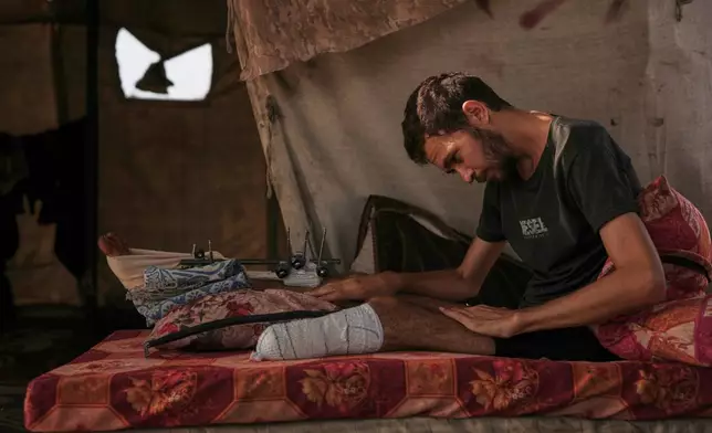 Yassin Marouf, 23, who lost his left foot and suffered a severe injury to his right leg after being hit by Israeli shelling in May, lies in a tent in Zawaida, central Gaza, Thursday, Nov. 6, 2025. (AP Photo/Abdel Kareem Hana)
