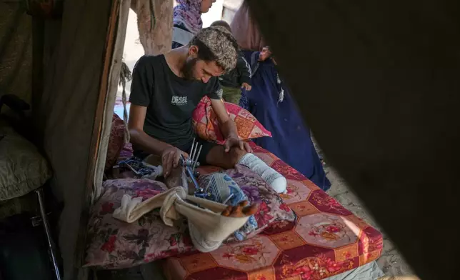 Yassin Marouf, 23, who lost his left foot and suffered a severe injury to his right leg after being hit by Israeli shelling in May, lies in a tent surrounded by his family in Zawaida, central Gaza, Thursday, Nov. 6, 2025. (AP Photo/Abdel Kareem Hana)