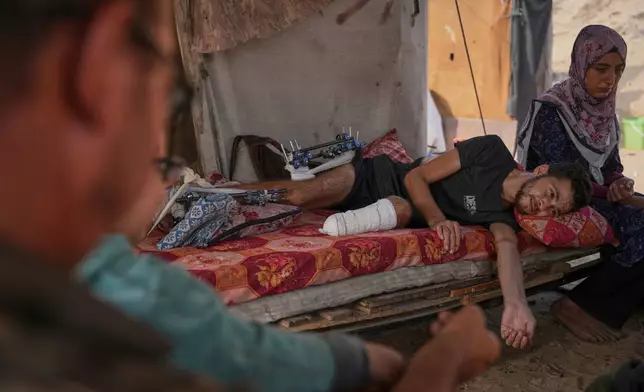 Yassin Marouf, 23, who lost his left foot and suffered a severe injury to his right leg after being hit by Israeli shelling in May, lies in a tent surrounded by his family in Zawaida, central Gaza, Thursday, Nov. 6, 2025. (AP Photo/Abdel Kareem Hana)