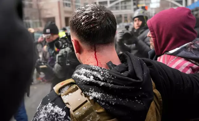 Jake Lang, center, who organized the protest March Against Minnesota Fraud, appears to bleed from the back of his head after clashing with pro-immigration counterprotesters near Minneapolis City Hall, Saturday, Jan. 17, 2026, in Minneapolis. (AP Photo/Yuki Iwamura)