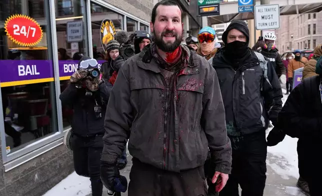 A Jake Lang supporter bleeds from his head as he is chased away by pro-immigration protesters Saturday, Jan. 17, 2026, in Minneapolis. (AP Photo/Yuki Iwamura)