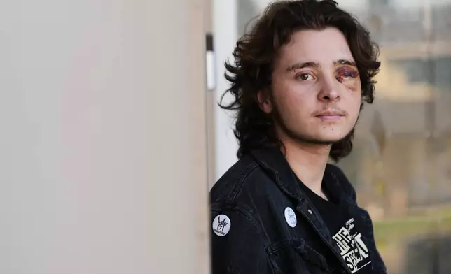 Kaden Rummler, who was injured after being hit with a projectile fired by a federal agent during a protest outside an immigration building in Santa Ana, Calif., poses for a portrait Wednesday, Jan. 14, 2026, in Southern California. (AP Photo/Damian Dovarganes)