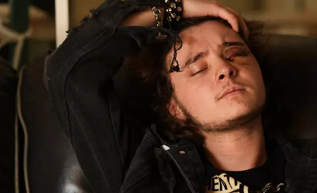 Kaden Rummler, who was injured after being hit with a projectile fired by a federal agent during a protest outside an immigration building in Santa Ana, Calif., sits on a couch at home Wednesday, Jan. 14, 2026, in Southern California. (AP Photo/Damian Dovarganes)