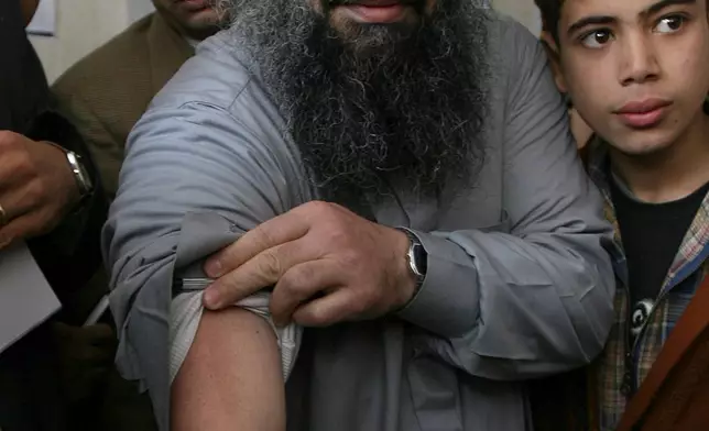 FILE - In this Feb. 22, 2007 file photo, Egyptian cleric Osama Hassan Mustafa Nasr, also known as Abu Omar, shows a dark scar on his arm during his first public appearance since he was released from Egyptian custody, in Alexandria, Egypt. (AP Photo/Nasser Nasser, File)