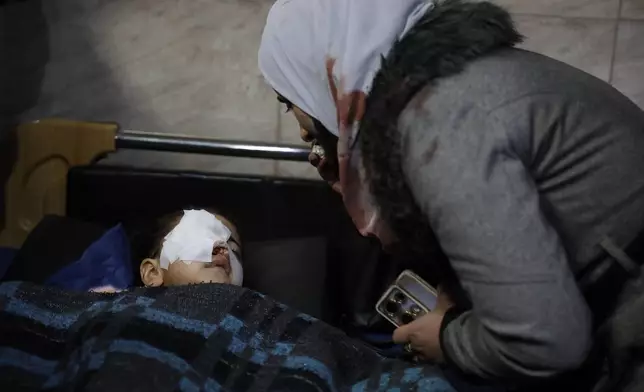 Kafaa Abu Sheikh, right, the mother of Syrian girl Fatima al-Zahra, 4, checks on her daughter who was wounded when clashes broke out between Syrian government forces and Kurdish fighters in a contested area of the northern city of Aleppo, Syria, Tuesday, Jan. 6, 2026. (AP Photo/Omar Albam)