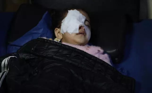 Syrian child Fatima al-Zahra Abu Sheikh, 4, lies in a hospital bed after being wounded when clashes broke out between Syrian government forces and Kurdish fighters in a contested area of the northern city of Aleppo, Syria, Tuesday, Jan. 6, 2026. (AP Photo/Omar Albam)