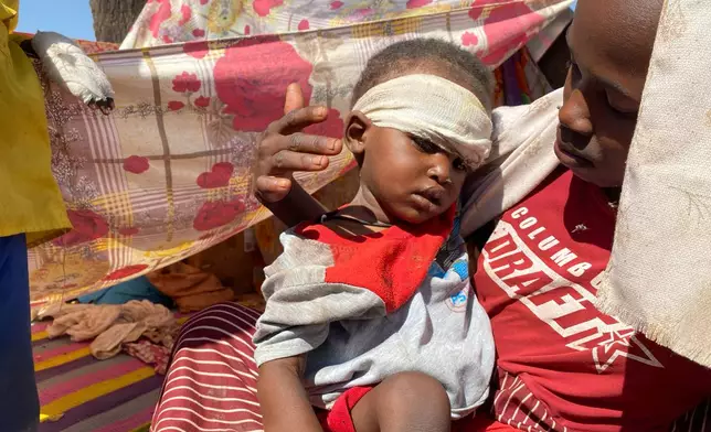 FILE - A Sudanese child, who fled el-Fasher city with family after Sudan's paramilitary forces attacked the western Darfur region, receives treatment at a camp in Tawila, Sudan, Nov. 2, 2025. (AP Photo/Mohammed Abaker, File)