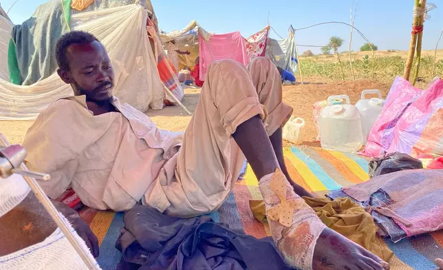 FILE - Al Shafiea Abdallah Holy, an injured Sudanese man who fled el-Fasher city after Sudan's paramilitary forces attacked the western Darfur region, receives medical care at a camp in Tawila, Sudan, Oct. 30, 2025. (AP Photo/Mohammed Abaker, File)