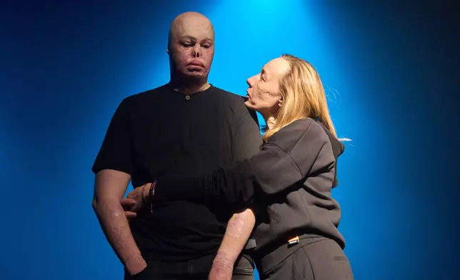 Director Olha Semioshkina supports Yehor Babenko a war veteran who sustained severe injuries in combat during Russia's full-scale invasion in Ukraine, before the premiere of an adaptation of Ivan Kotliarevskyi’s “Eneida,” a Ukrainian reimagining of Virgil’s “Aeneid,” in Kyiv, Ukraine, Thursday, Feb. 19, 2026. (AP Photo/Efrem Lukatsky)