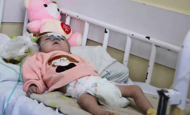 Samir, a 6-month-old from the far northeastern province of Badakhshan who is suffering from a heart condition and severe pneumonia compounded by malnutrition, lies in a hospital bed at Ataturk National Children's Hospital in Kabul, Afghanistan, Sunday, Feb. 15, 2026. (AP Photo/Siddiqullah Alizai)