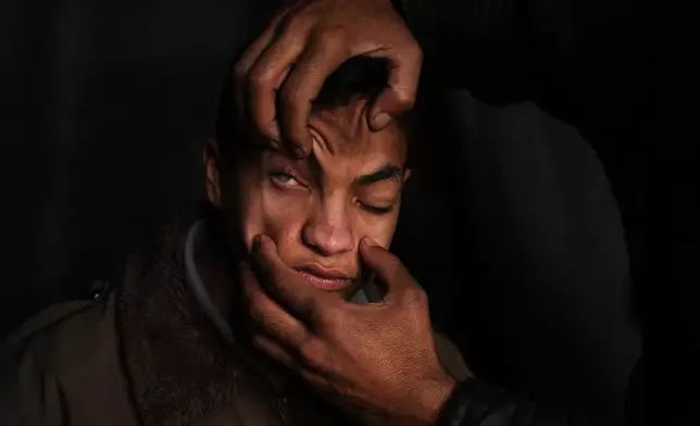 FILE - Mahmoud Abu Ishaq, 14, who is suffering vision loss due to a corneal condition, has his eye shown to the camera by his father as they await permission to travel outside the Gaza Strip for medical treatment, in Khan Younis, Jan. 27, 2026. (AP Photo/Abdel Kareem Hana, File)