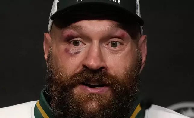 FILE - Britain's boxer Tyson Fury speaks at a press conference after loosing his fight against Ukraine's boxer Oleksandr Usyk for the WBA, WBO, and WBC heavyweight title in Riyadh, Saudi Arabia, on Dec. 22, 2024. (AP Photo/Frank Augstein, File)