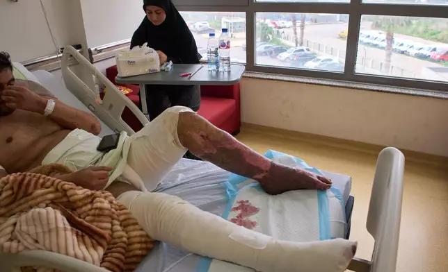 A man with burn wounds from an Israeli airstrike on southern Lebanon lying in bed at the Sidon Government Hospital in Sidon, Lebanon, Thursday, April 2, 2026. (AP Photo/Emilio Morenatti)