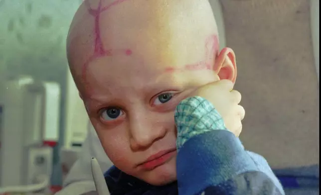 FILE - Alec Zhloba sits in a children's cancer ward with markings made by doctors on his head following chemotherapy in Gomel, Belarus, March 19, 1996, nearly 10 years after the explosion and fire at the Chernobyl nuclear power plant sent radioactive clouds through Ukraine, Belarus and other parts of Europe. (AP Photo/Efrem Lukatsky, File)