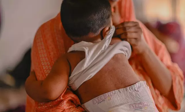 A woman comforts her child receiving treatment for measles at the Infectious Diseases Hospital in Dhaka, Bangladesh, Monday, April 6, 2026, amid a countrywide outbreak. (AP Photo/Mahmud Hossain Opu)