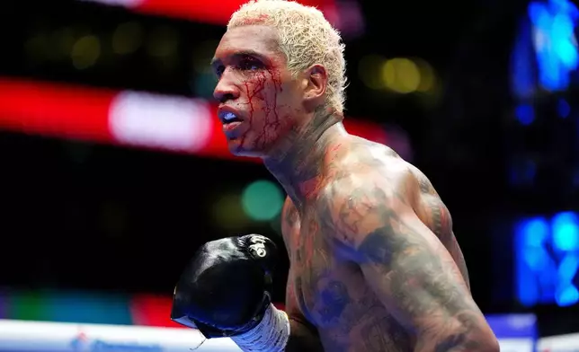 Boxers Conor Benn's face is bloodied during welterweight bout Regis Prograis at Tottenham Hotspur Stadium in London, Saturday, April 11, 2026. (Bradley Collyer/PA via AP)