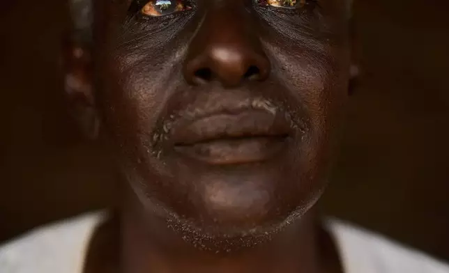 Abbas Awad, 61, who suffers from glaucoma, poses for a portrait at his home in Qoz Nafisa village, Khartoum state, Sudan, Wednesday, April 22, 2026. (AP Photo/Bernat Armangue)