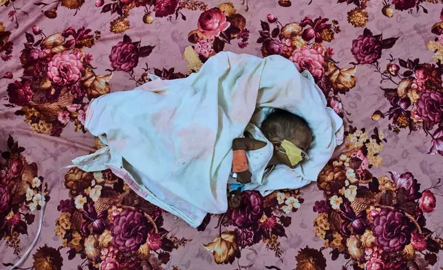 FILE - Patient Saidal Altaher, aged two months, receives treatment for malnutrition at the paediatric hospital stabilization center in Port Sudan, Sudan, Wednesday, April 15, 2026. (AP Photo/Bernat Armangue, File)