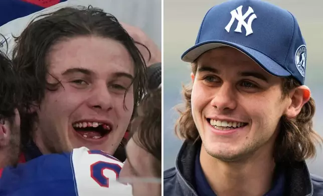 FILE - This combo of file photos show hockey player Jack Hughes, left, celebrating after the gold medal game against Canada in Milan, Italy, and at right, at Yankee Stadium sporting a new smile before a New York Yankees baseball game in New York. (AP Photo/File)